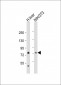 PCCA Antibody (Center)